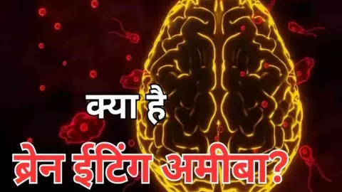 Brain Eating Amoeba Brain Eating Amoeba