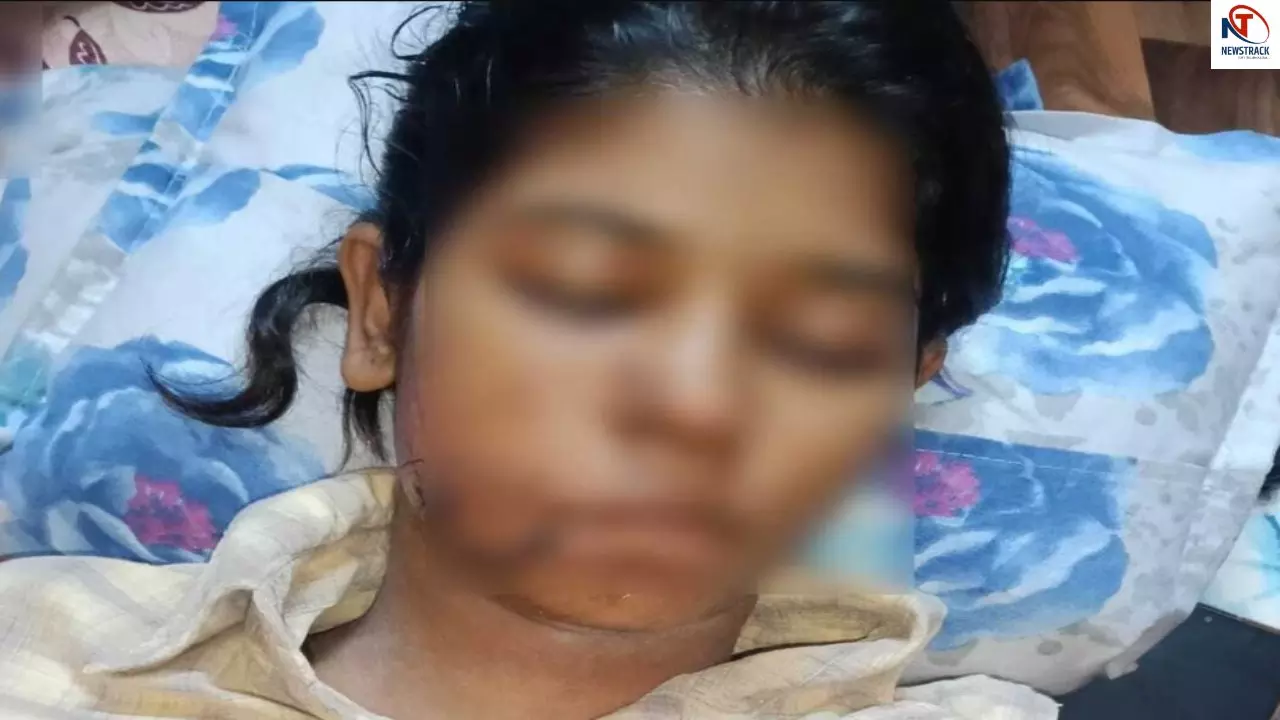 Dog attack in Kanpur
