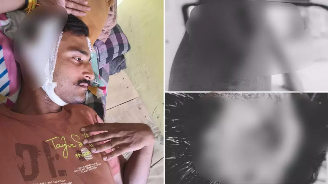 कॉल पर इमरजेंसी कहकर एम्बुलेंस को KGMU बुलाया, आते ही बदमाशों ने रॉड से किया हमला, FIR दर्ज कर जांच नें जुटी लखनऊ पुलिस