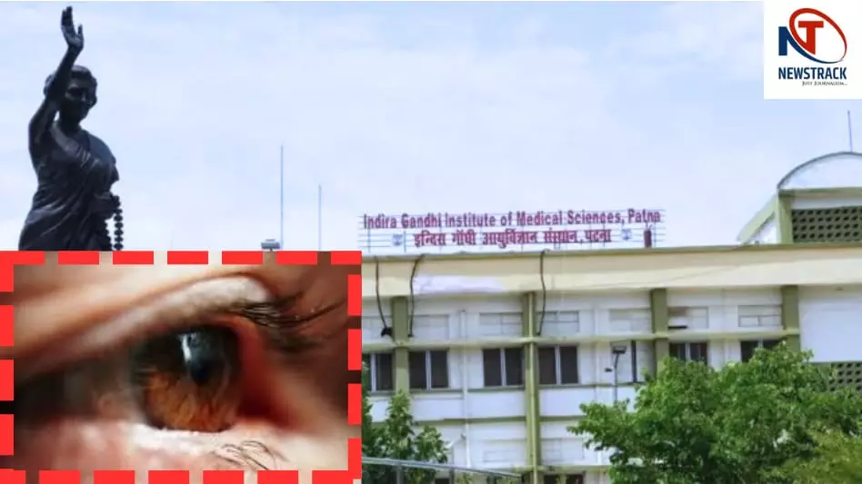 IGIMS Patna surgery