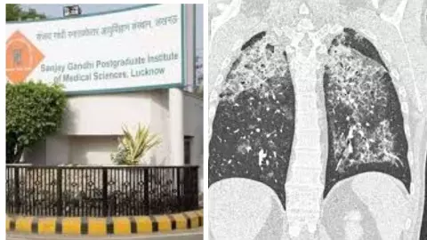 Lucknow News Lucknow News