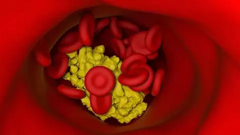Cholesterol To Power The Electronics