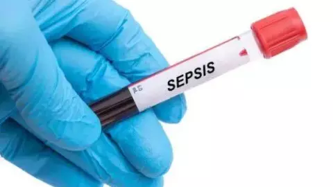 सेप्सिस बीमारी में समय पर इलाज न मिलने पर जा सकती है जान, विशेषज्ञ बोले लापरवाही खतरनाक