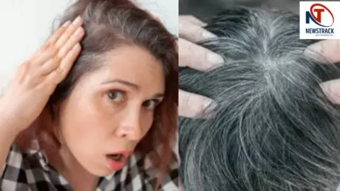 Causes of White Hair, vitamin D deficieny Causes of White Hair, vitamin D deficieny
