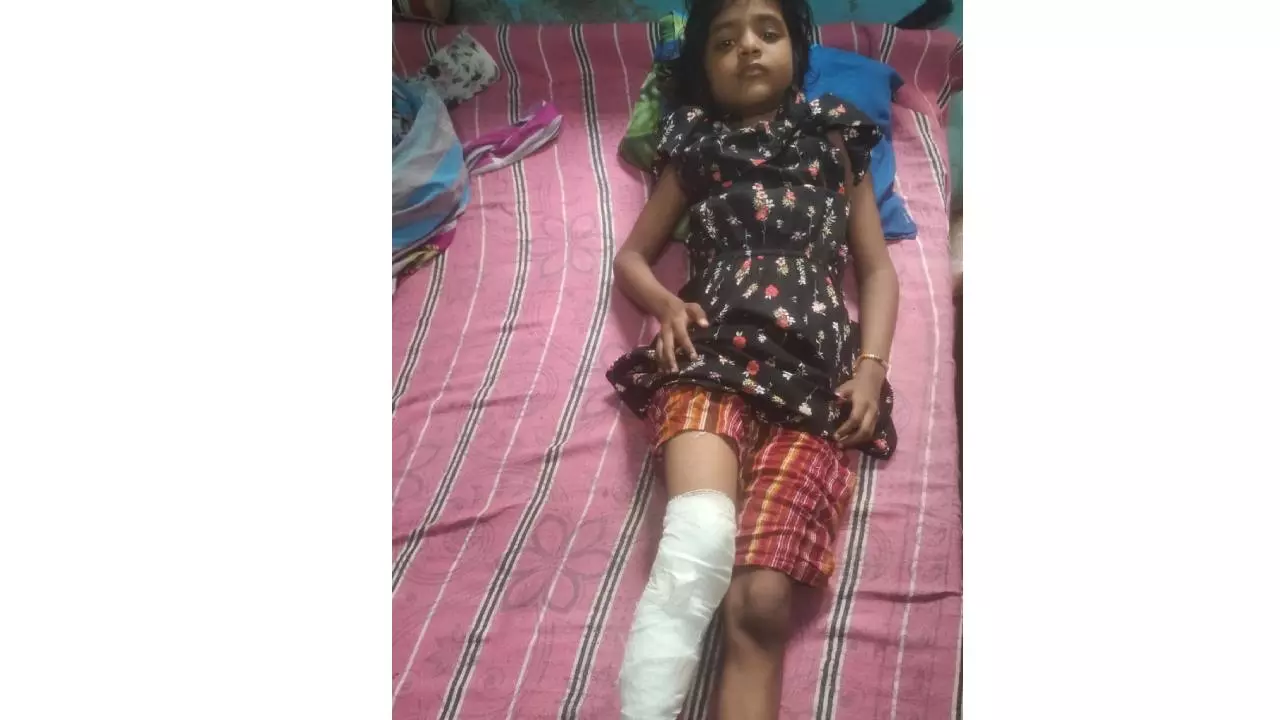 Baghpat News: बड़ौत में बंदरों का आतंक: 6 वर्षीय बच्ची पर हमला, हालत नाजुक