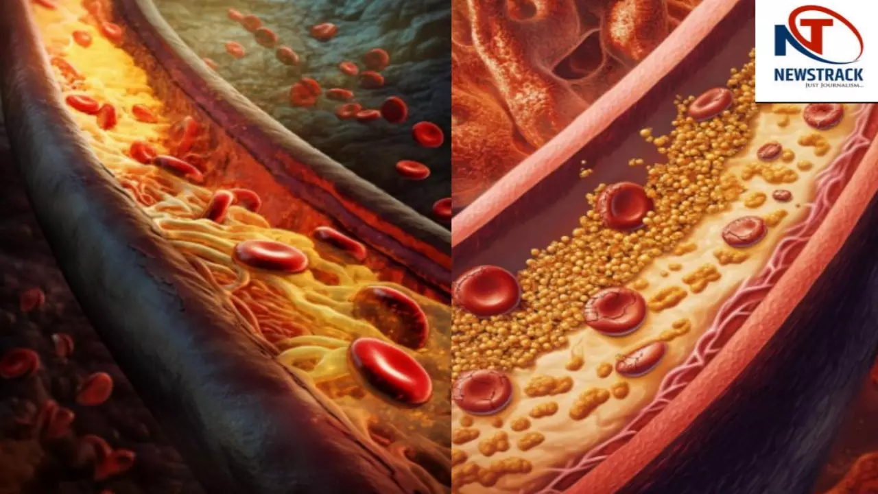 Foods to reduce cholesterol, cholesterol
