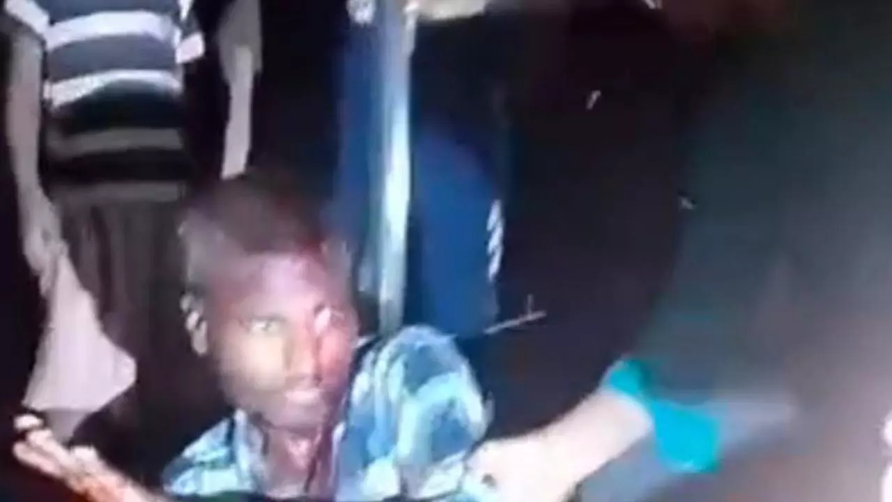 Azamgarh News: चोरी की आशंका में मंदबुद्धि युवक की बेरहमी से पिटाई