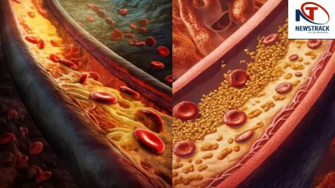 Foods to reduce cholesterol, cholesterol