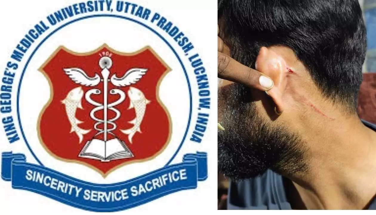 नशे में धुत केजीएमयू के जूनियर रेजिडेंटों ने निर्सिंग ऑफिसर को पीटा