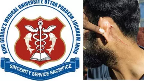 नशे में धुत केजीएमयू के जूनियर रेजिडेंटों ने निर्सिंग ऑफिसर को पीटा नशे में धुत केजीएमयू के जूनियर रेजिडेंटों ने निर्सिंग ऑफिसर को पीटा