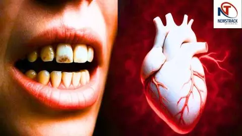 Oral Health Linked To Heart Attack