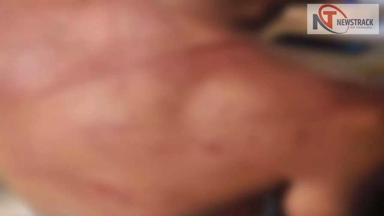 beating of youth held hostage in guest house
