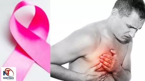 Breast Cancer in Men Breast Cancer in Men