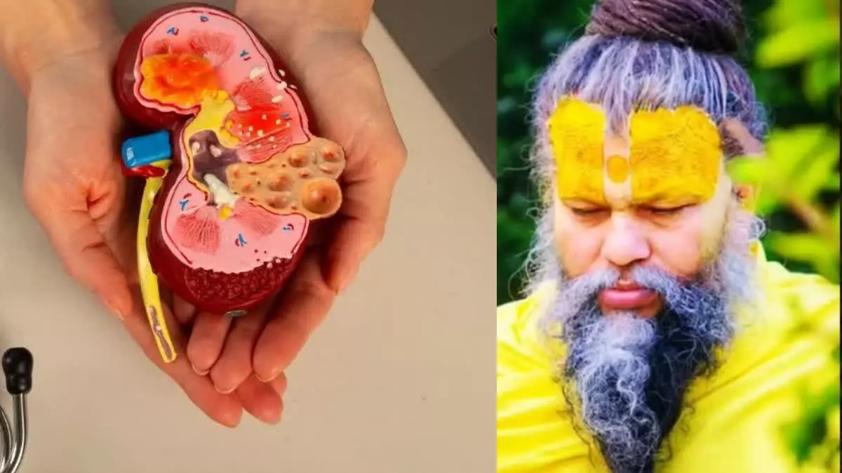 Premanand Maharaj Kidney Disease