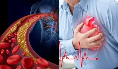 Heart Attack Prevention