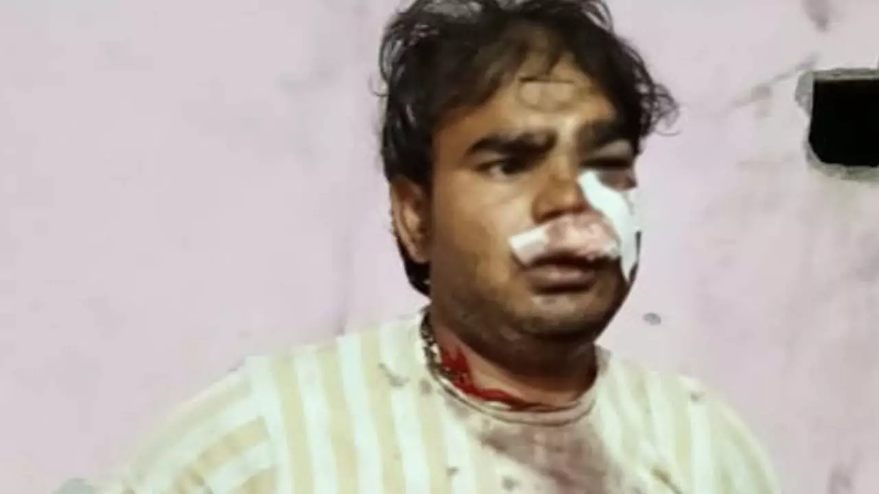 Clash in Vrindavan over firecrackers; women, youth injured