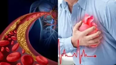 Heart Attack Prevention Heart Attack Prevention
