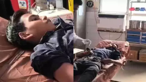 Etah News: ट्यूशन से लौट रहे किशोर पर गिरी हाईटेंशन लाइन, एक पैर कटा, हालत गंभीर