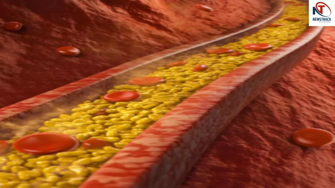 Cholesterol Control Tips