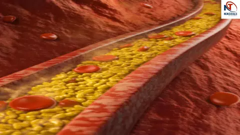 Cholesterol Control Tips Cholesterol Control Tips