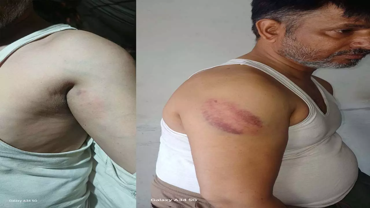 Disabled shopkeeper accused of beating up police in Mathura, outrage in area Disabled shopkeeper accused of beating up police in Mathura, outrage in area