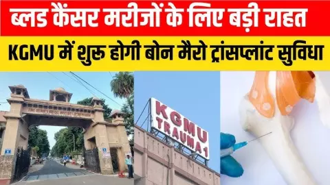 KGMU Bone Marrow Transplant KGMU Bone Marrow Transplant