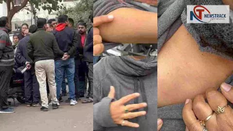 मेरी छाती छू रहे थे… लड़की के भाजपा पार्षद और लखनऊ नगर निगम पर गंभीर आरोप, कुत्तों को बचाने थी पहुंची मेरी छाती छू रहे थे… लड़की के भाजपा पार्षद और लखनऊ नगर निगम पर गंभीर आरोप, कुत्तों को बचाने थी पहुंची