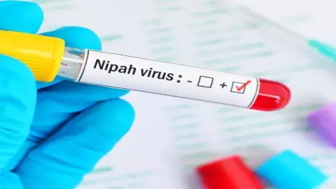 Nipah Virus