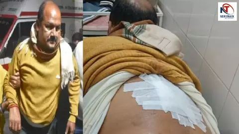 BJP नेता पर ताबड़तोड़ फायरिंग... UP में बदमाशों के हौसले बुलंद... खुलेआम कर रहे दुस्साहस! BJP नेता पर ताबड़तोड़ फायरिंग... UP में बदमाशों के हौसले बुलंद... खुलेआम कर रहे दुस्साहस!