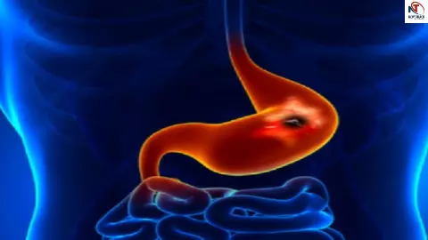 Gut Health Ayurveda Gut Health Ayurveda