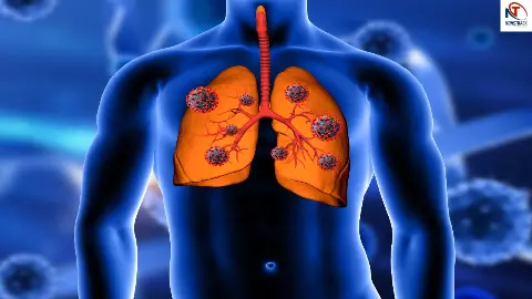 Ayurvedic Remedies For Lung
