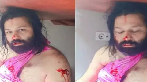Ashutosh Brahmachari Attack