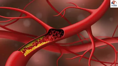 Arjun Bark Benefits