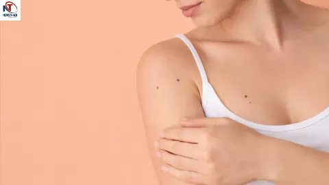 Private Part Mole Meaning