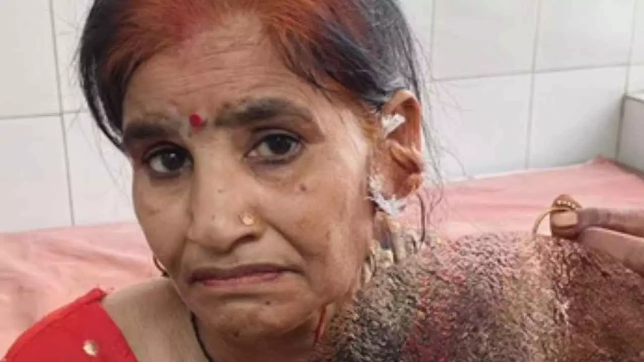 Etah News: एटा में दो भाइयों के परिवारों में खूनी संघर्ष, लाठी-डंडों से झड़प में महिला घायल