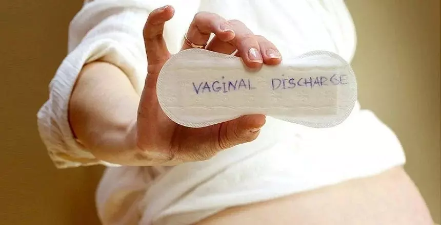 White Vaginal Discharge