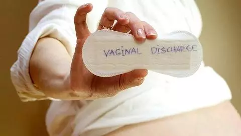 White Vaginal Discharge