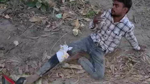 Muzaffarnagar: मुठभेड़ में घायल बदमाश दर्द से नहीं, तलब में चिल्लाया – साहब, दो एक बीड़ी पिलवा दो Muzaffarnagar: मुठभेड़ में घायल बदमाश दर्द से नहीं, तलब में चिल्लाया – साहब, दो एक बीड़ी पिलवा दो