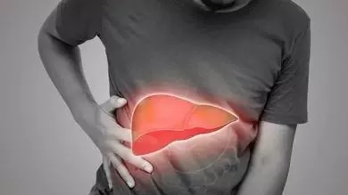 Fatty Liver