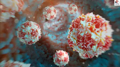 Polio Virus Detected