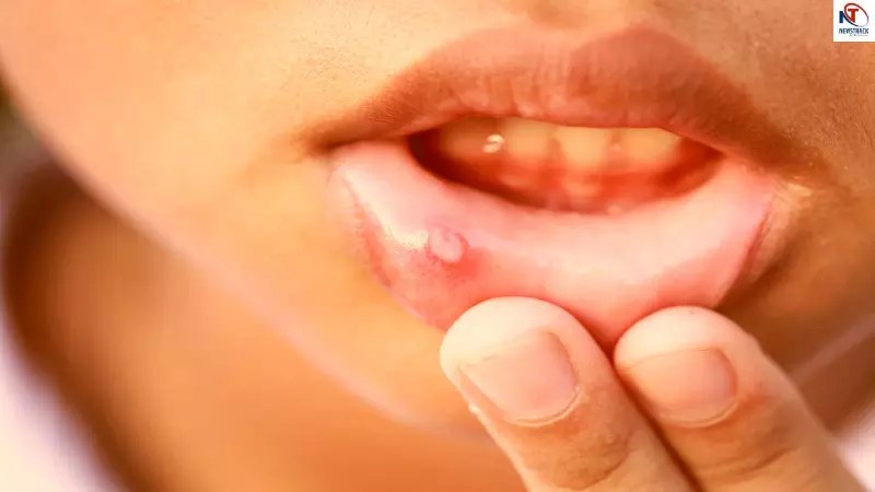 Oral Cancer Symptoms Oral Cancer Symptoms