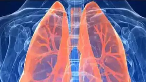 MP News: AIIMS Bhopal में शुरू होगी लंग्स ट्रांसप्लांट सुविधा, 20 लाख में होगा इलाज, नहीं जाना पड़ेगा दिल्ली-चेन्नई