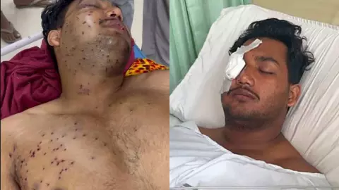 मुझे कुछ दिखाई नहीं दे रहा... 19 साल के साहिल की आंख में लगा पेलेट गन का छर्रा, अब आंखों के आगे सिर्फ अंधेरा मुझे कुछ दिखाई नहीं दे रहा... 19 साल के साहिल की आंख में लगा पेलेट गन का छर्रा, अब आंखों के आगे सिर्फ अंधेरा