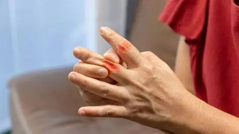 How to Reduce Uric Acid How to Reduce Uric Acid