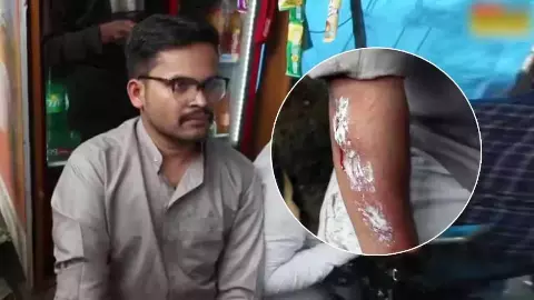 रांची में छात्रों पर पुलिस ने जमकर बरसीं लाठियां! बुरी तरह घायल हुए कई छात्र, अभ्यर्थी ने खुद सुनाई आपबीती