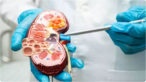 Chronic Kidney Disease India Chronic Kidney Disease India