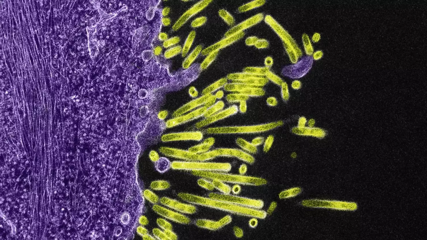 Swine Flu Symptoms