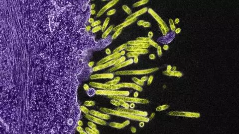 Swine Flu Symptoms Swine Flu Symptoms