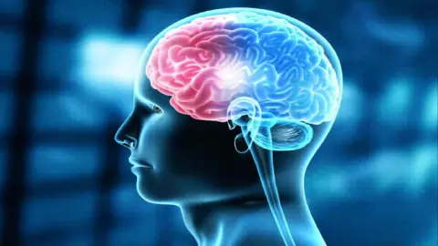 Bilingual Brain Bilingual Brain