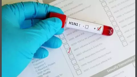 Hathras News: H1N1 को लेकर हाथरस स्वास्थ्य विभाग ने जारी की जरूरी एडवाइजरी